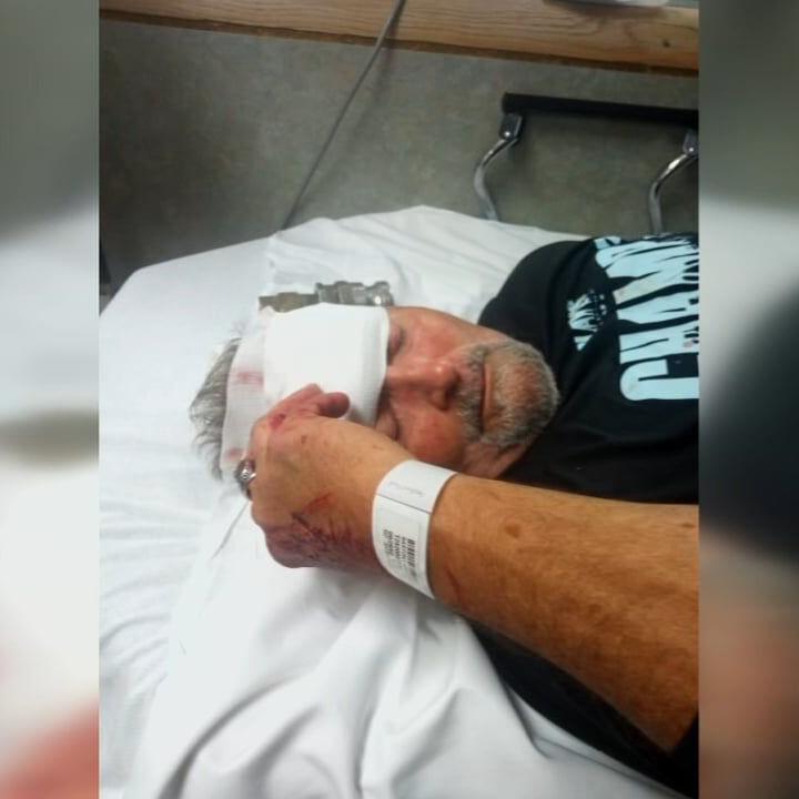 Louisville man hit in the head with metal debris on Sherman Minton Bridge